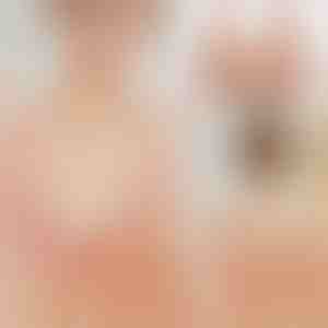 Удобен и проветлив градник | FRONTBRA