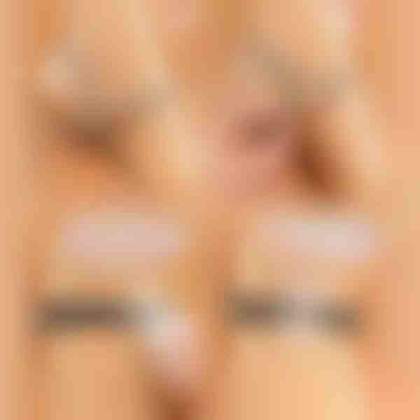 LUXSTRAP Image